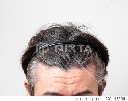 The head of a man who cares about gray hair and thinning hair The head of a man who cares about gray hair and thinning hair 101197566