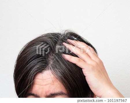 The head of a man who cares about gray hair and thinning hair 101197567