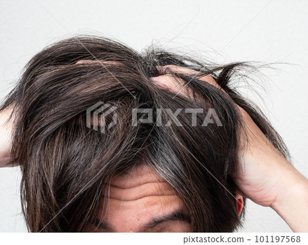 The head of a man who cares about gray hair and thinning hair 101197568