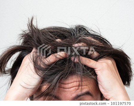 The head of a man who cares about gray hair and thinning hair 101197570