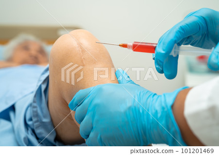 Asian doctor inject Hyaluronic acid platelet rich plasma into the knee of senior woman to walk without pain. 101201469