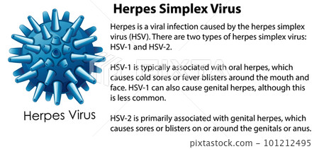 Herpes Simplex Virus with explanation 101212495