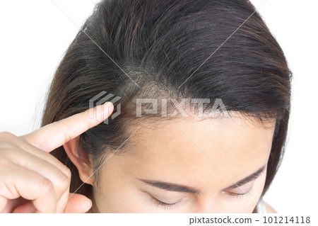 Close up woman hand holding hair loss problem for health care shampoo and beauty product concept 101214118