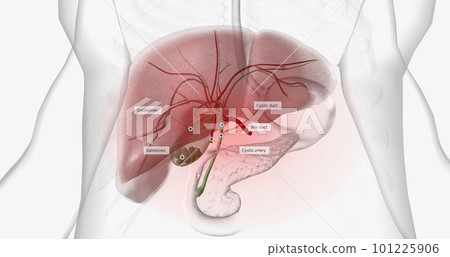 Gallstones are pieces of solid material that form in the gallbladder, a small hollow organ located beneath the liver. Gallstones are pieces of solid material that form in the gallbladder, a small hollow organ located beneath the liver. 101225906