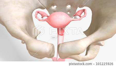 Chlamydia is a sexually transmitted infection caused by Chlamydia trachomatis bacteria. 101225926