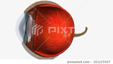 Higher than normal intraocular pressure in the absence of ocular hypertension, optic nerve damage, or visual field loss Higher than normal intraocular pressure in the absence of ocular hypertension, optic nerve damage, or visual field loss 101225937