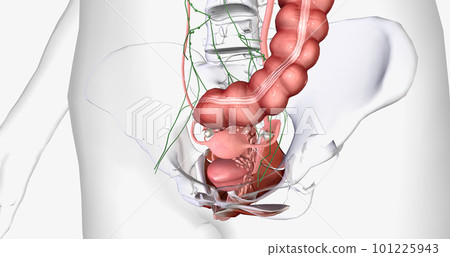 In stage IV, the cancer spreads to invade nearby organs, such as the bladder, rectum, and kidneys. In stage IV, the cancer spreads to invade nearby organs, such as the bladder, rectum, and kidneys. 101225943