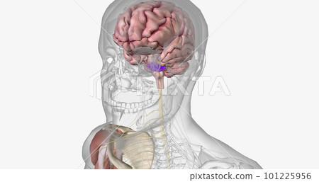 Amyotropic lateral sclerosis (ALS) is a progressive neurodegenerative disorder caused by the death of motor neurons. 101225956