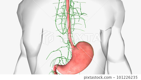 In stage I esophageal cancer, the tumor has spread through some of the layers of the esophageal wall. 101226235