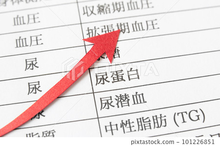Urinary protein and rising arrow Medical checkup Rising arrow Health checkup items Urinary protein and rising arrow Medical checkup Rising arrow Health checkup items 101226851