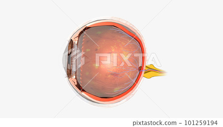 Diabetic retinopathy is a complication of diabetes that affects the eyes. Diabetic retinopathy is a complication of diabetes that affects the eyes. 101259194
