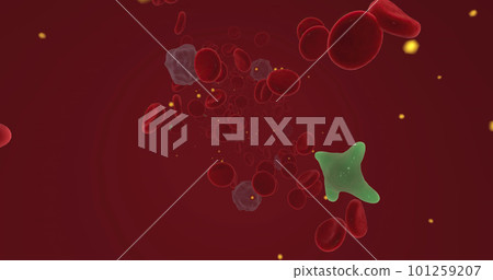 Hypercalcemia is a condition characterized by increased calcium levels in the blood. 101259207