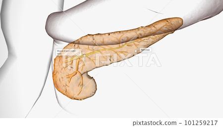 Cystic fibrosis (CF) is a genetic disorder characterized by thick mucus production. Cystic fibrosis (CF) is a genetic disorder characterized by thick mucus production. 101259217