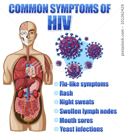 Informative poster of common symptoms of HIV 101262429