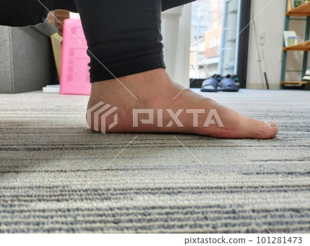 flat feet 101281473