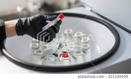 The doctor takes out a test tube with blood plasma from the centrifuge. Plasma lifting procedure for skin rejuvenation. The doctor takes out a test tube with blood plasma from the centrifuge. Plasma lifting procedure for skin rejuvenation. 101289509