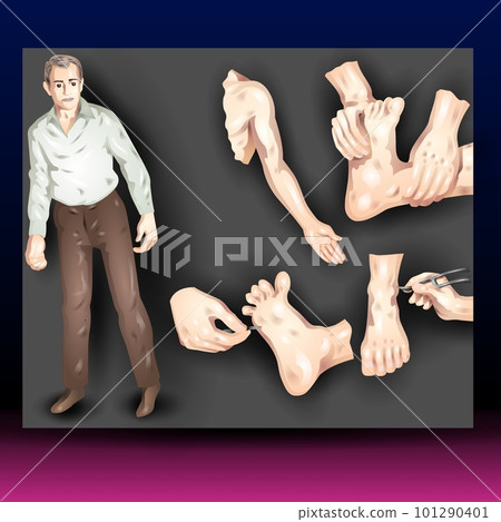 Loss of Sensation Loss of Sensation 101290401