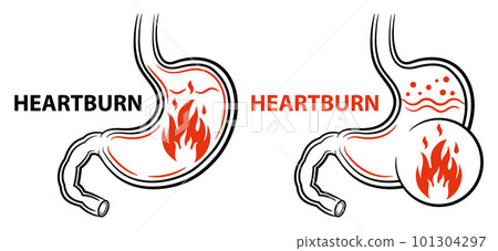Heartburn, stomach burning fire pain, gastritis, GERD gastroesophageal acid reflux disease, gastric ulcer line icon set. Medical treatment indigestion digestive system, high gastrointestinal acidity Heartburn, stomach burning fire pain, gastritis, GERD gastroesophageal acid reflux disease, gastric ulcer line icon set. Medical treatment indigestion digestive system, high gastrointestinal acidity 101304297