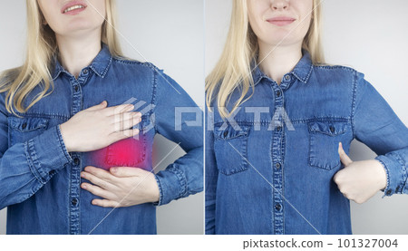 Woman suffers from pain in the mammary gland. On examination by a gynecologist-mammologist. The concept of prevention of diseases of the breast, cancer, mastopathy or hormonal disorders 101327004