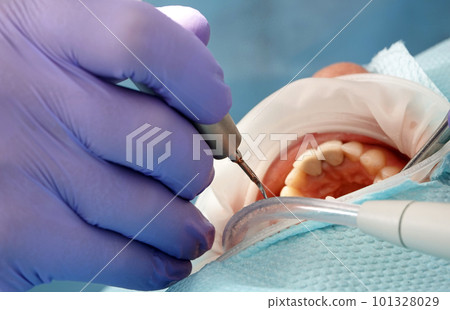 Kiev, Ukraine August 22, 2020: Dentist doctor works with a patient close-up Kiev, Ukraine August 22, 2020: Dentist doctor works with a patient close-up 101328029