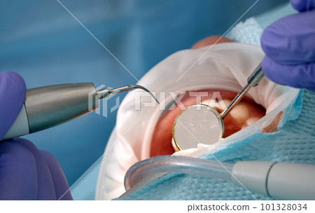 Kiev, Ukraine August 22, 2020: Dentist doctor works with a patient close-up Kiev, Ukraine August 22, 2020: Dentist doctor works with a patient close-up 101328034
