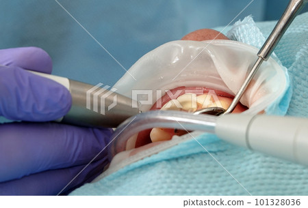 Kiev, Ukraine August 22, 2020: Dentist doctor works with a patient close-up Kiev, Ukraine August 22, 2020: Dentist doctor works with a patient close-up 101328036