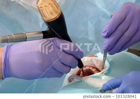 Kiev, Ukraine August 22, 2020: Dentist doctor works with a patient close-up Kiev, Ukraine August 22, 2020: Dentist doctor works with a patient close-up 101328041