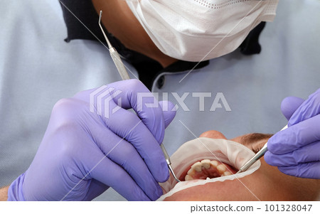 Kiev, Ukraine August 22, 2020: Dentist doctor works with a patient close-up Kiev, Ukraine August 22, 2020: Dentist doctor works with a patient close-up 101328047