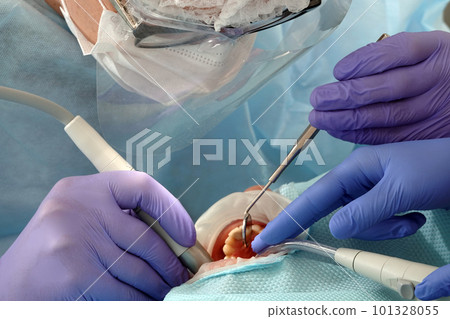 Kiev, Ukraine August 22, 2020: Dentist doctor works with a patient close-up Kiev, Ukraine August 22, 2020: Dentist doctor works with a patient close-up 101328055