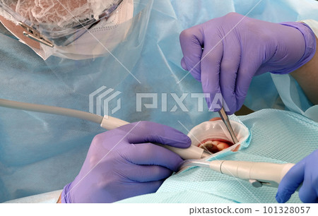 Kiev, Ukraine August 22, 2020: Dentist doctor works with a patient close-up 101328057