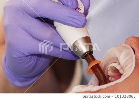 Kiev, Ukraine August 22, 2020: Dentist doctor works with a patient close-up Kiev, Ukraine August 22, 2020: Dentist doctor works with a patient close-up 101328065