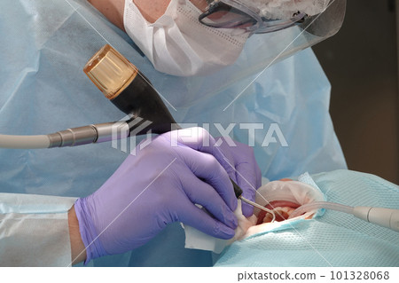 Kiev, Ukraine August 22, 2020: Dentist doctor works with a patient close-up Kiev, Ukraine August 22, 2020: Dentist doctor works with a patient close-up 101328068