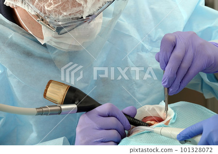 Kiev, Ukraine August 22, 2020: Dentist doctor works with a patient close-up 101328072