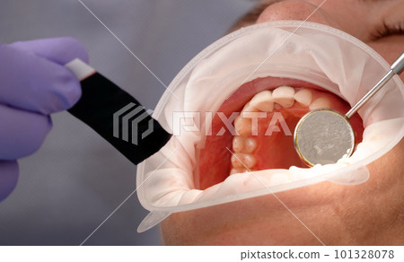 Kiev, Ukraine August 22, 2020: Dentist doctor works with a patient close-up Kiev, Ukraine August 22, 2020: Dentist doctor works with a patient close-up 101328078