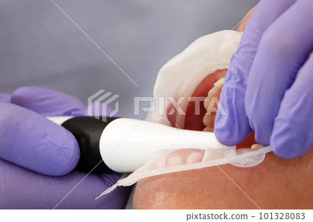 Kiev, Ukraine August 22, 2020: Dentist doctor works with a patient close-up Kiev, Ukraine August 22, 2020: Dentist doctor works with a patient close-up 101328083