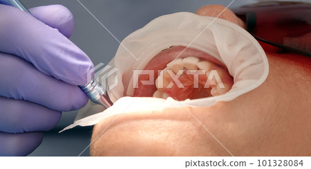 Kiev, Ukraine August 22, 2020: Dentist doctor works with a patient close-up Kiev, Ukraine August 22, 2020: Dentist doctor works with a patient close-up 101328084