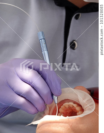 Kiev, Ukraine August 22, 2020: Dentist doctor works with a patient close-up Kiev, Ukraine August 22, 2020: Dentist doctor works with a patient close-up 101328085