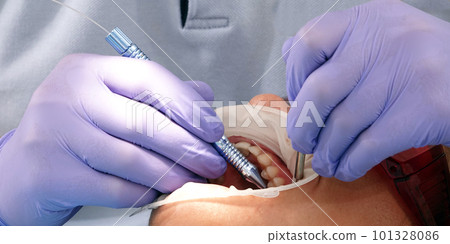 Kiev, Ukraine August 22, 2020: Dentist doctor works with a patient close-up Kiev, Ukraine August 22, 2020: Dentist doctor works with a patient close-up 101328086