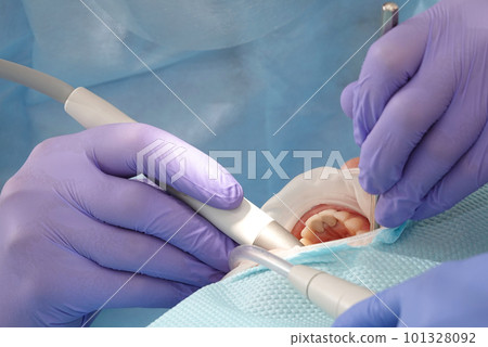 Kiev, Ukraine August 22, 2020: Dentist doctor works with a patient close-up Kiev, Ukraine August 22, 2020: Dentist doctor works with a patient close-up 101328092