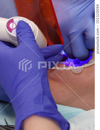 Kiev, Ukraine August 22, 2020: Dentist doctor works with a patient close-up 101328094