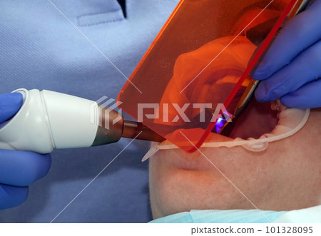 Kiev, Ukraine August 22, 2020: Dentist doctor works with a patient close-up Kiev, Ukraine August 22, 2020: Dentist doctor works with a patient close-up 101328095
