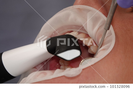 Kiev, Ukraine August 22, 2020: Dentist doctor works with a patient close-up Kiev, Ukraine August 22, 2020: Dentist doctor works with a patient close-up 101328096
