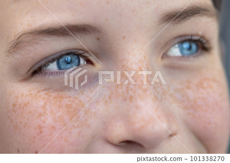 Close-up photo. Body part. Young happy and joyful face in freckles, blue eyes of a child, teenager, looking away. Close-up photo. Body part. Young happy and joyful face in freckles, blue eyes of a child, teenager, looking away. 101338270