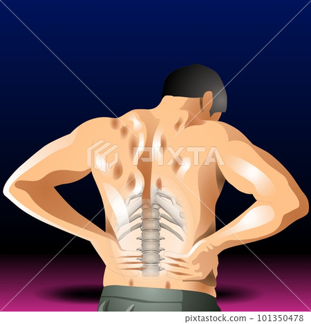 Man with Back Ache 101350478