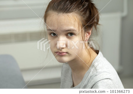 Portrait Of Sad Child, Girl With Cerebral Palsy in Hospital Looking At Camera. Rehabilitation. Balance And Posture Maintenance, Cure. Horizontal plane plane Portrait Of Sad Child, Girl With Cerebral Palsy in Hospital Looking At Camera. Rehabilitation. Balance And Posture Maintenance, Cure. Horizontal plane plane 101366273