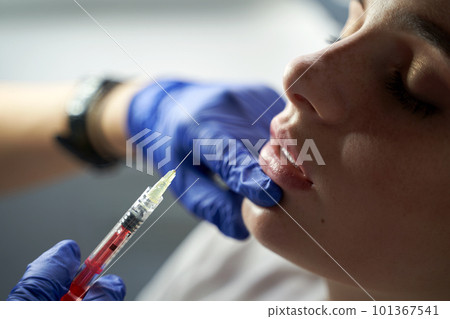 Lip augmentation and correction procedure in a cosmetology salon. The specialist makes an injection in the patient's lips 101367541
