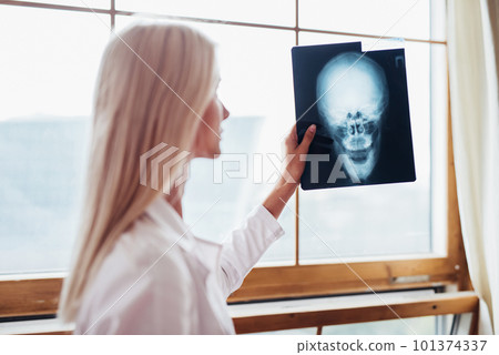 Woman Doctor Looking at X-Ray Radiography in hospital. Woman Doctor Looking at X-Ray Radiography in hospital. 101374337