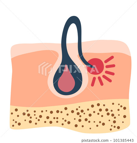 0215_hair 0215_hair 101385443