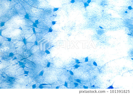 Motor neuron cells, whole mount, 8X light micrograph. Motoneurons under a light microscope. Motor neurous cells, also called efferent neurons, with axons, nerve fibers, that carry electrical signals. 101391825
