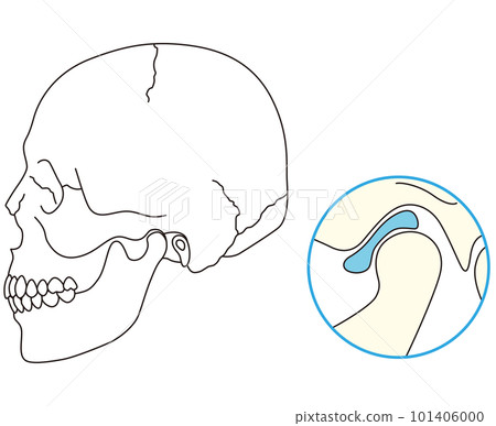 Normal jaw joint disc temporomandibular joint disorder 101406000